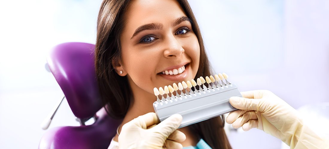 Faccette dentali | Studio Dentistico Calvi