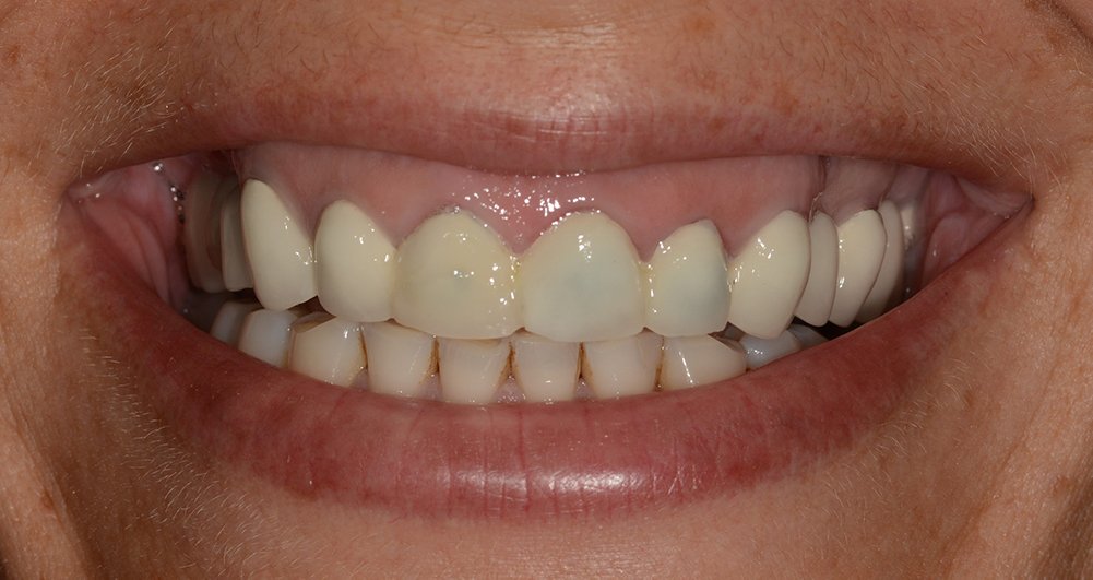 Estetica dentale | Studio Dentistico Calvi