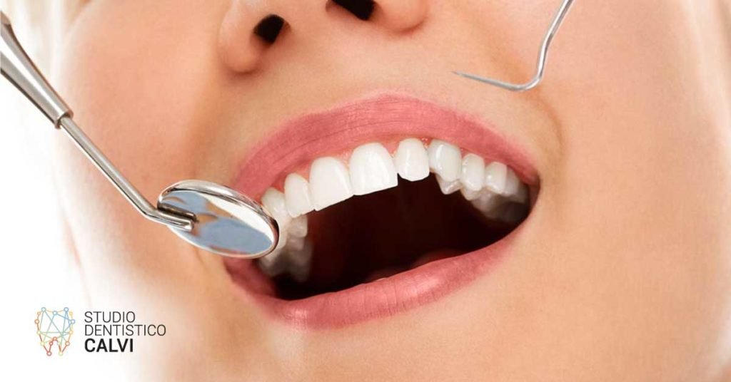 Pulizia delle tasche gengivali | Studio Dentistico Calvi