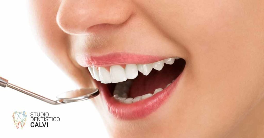 Sintomi della gengivite | Studio Dentistico Calvi