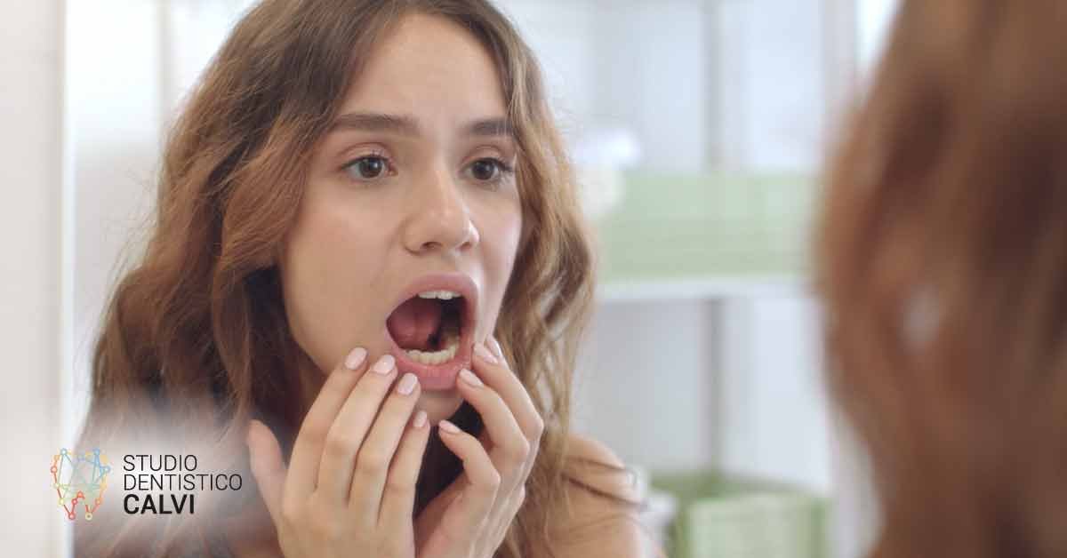Gengive bianche | Studio Dentistico Calvi