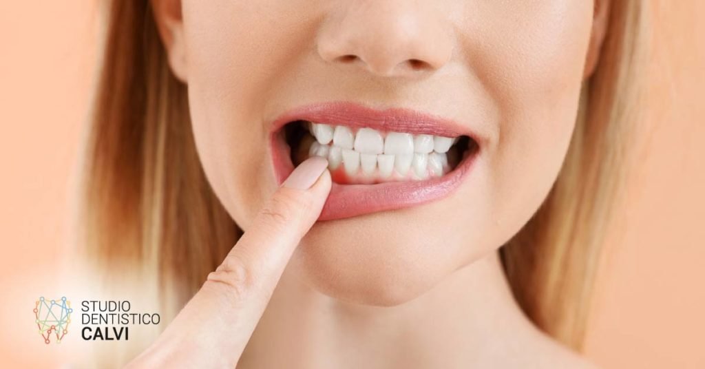 Solco gengivale | Studio Dentistico Calvi